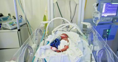 Yenidoğan, sağlık ve istikrar için gelişmiş izleme teknolojisine sahip bir yoğun bakımda özel bakım görüyor. Yeni doğmuş bir bebek, Yenidoğan Bakım Ünitesinde özel ilgi ve destek görüyor.