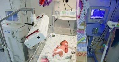 Yeni doğan bebek yeni doğan bakım ünitesinde, çok önemli tıbbi bakım ve özel destek alıyor. Bebek yeni doğan bakım ünitesinde, çok önemli tıbbi bakım ve özel destek alıyor.