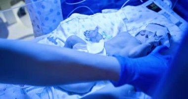 Yeni doğan bebeğe NICU sağlık hizmetlerinde yardım eden tıbbi personel. Bebek sarılık tedavisi için mavi ışık terapisi gördüğü bir kuvöze yerleştirilir.