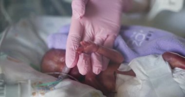 Narin bir prematüre bebek yoğun bakımda hassas bakım görüyor. Umudun ve desteğin derin bağını vurguluyor. NICU Ünitesinde prematüre bebekler için şefkatli ve çalışkan bakım sağlanması