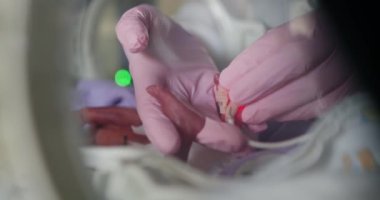 Yenidoğan yoğun bakım ünitesinde korunmasız bir prematüre bebeğe nazik ve şefkatli bir dokunuş. Yenidoğan Bakımı Tehlike Altındaki Bebeklere Gerekli IV Destek Servisi