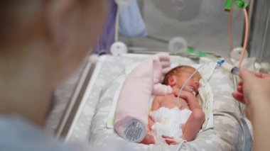 Yenidoğan yoğun bakım ünitesindeki prematüre bir bebek bir şırıngadan, donör anne sütünden besleniyor. Kaynağın tıbbi bir ortamda gösterilmesi.