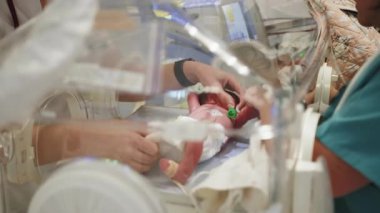 Yenidoğan yoğun bakım ünitesinde prematüre bir bebeğe bakılıyor, tıbbi personel de katılıyor. Prematüre bir bebek, yenidoğan yoğun bakım ünitesinde bakım görür.
