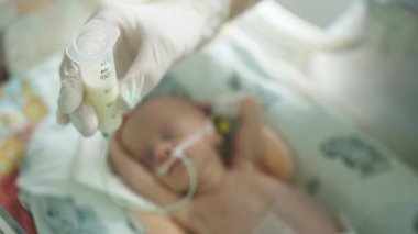 Prematüre bir bebek yenidoğan yoğun bakım ünitesinde süt içerek hassas yeni doğan bebeklerin bakımını ön plana çıkarır. NICU 'da prematüre bebek sütü