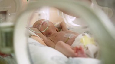 Prematüre bir bebek, yeni doğan yoğun bakım ünitesinde bakım gören bir inkübatörde sütle beslenir. Bir hemşire, bebeklerin sağlığını sağlamak için şırıngayla beslenmeyi dikkatlice yönetir..