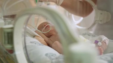 Prematüre bir bebek, yeni doğan yoğun bakım ünitesinde bakım gören bir inkübatörde sütle beslenir. NICU 'da prematüre bir bebeği beslemek