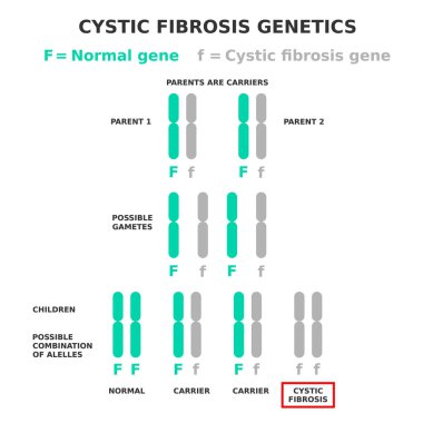 Cystic fibrosis genetics. Cystic fibrosis is an example of a recessive disease. Parents are carriers of affected allele. Children have different possible combination of genes. Vector illustration.  clipart