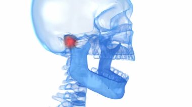 Temporomandibular eklem sorunu. Tıbbi olarak doğru 3B canlandırma