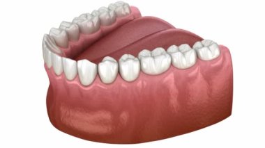 Dental Root anatomy of mandibular human gum and teeth, x-ray view. Medically accurate tooth 3D animation