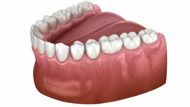 Οδοντιατρική Ανατομία Της Κάτω Γνάθου Ανθρώπινη Τσίχλα Και Δόντια Ακτινογραφία — Αρχείο Βίντεο