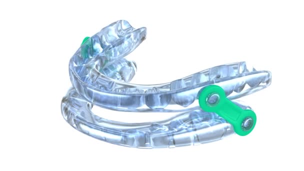 口器治疗装置 睡眠呼吸暂停治疗 3D动画 — 图库视频影像