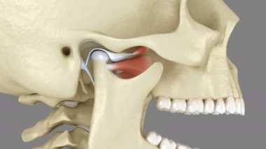 Temporomandibular eklemler ve çıkık eklem diski. Tıbbi olarak doğru 3B canlandırma