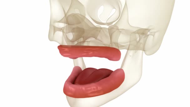 Removable Prosthesis Artificial Gum Teeth Dental Animation — Video Stock