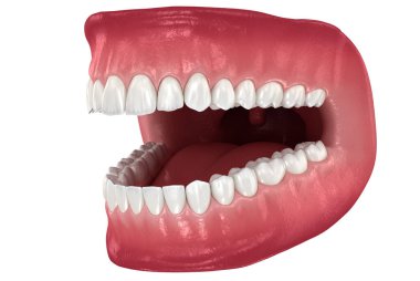 Diş anatomisi - Açık Protezler. Tıbbi olarak doğru diş 3d illüstrasyon