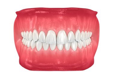 Normal tıkanıklığı olan sağlıklı insan dişleri. Tıbbi olarak doğru diş 3D illüstrasyon