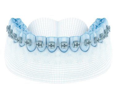 Diş telleri ve takma dişler. Kablo 3d model illüstrasyonu