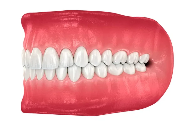 Denti Umani Sani Con Normale Occlusione Illustrazione Del Dente Clinicamente — Foto Stock