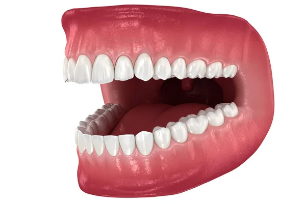 Diş Anatomisi Açık Protezler Tıbbi Olarak Doğru Diş Illüstrasyon — Stok fotoğraf