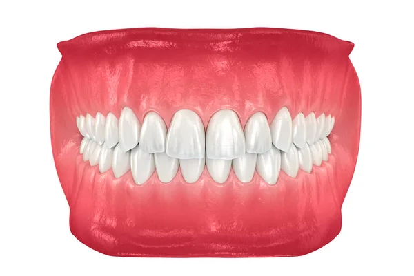Здоровые Человеческие Зубы Нормальной Окклюзией Медицинская Точность Трехмерной Иллюстрации Зубов — стоковое фото