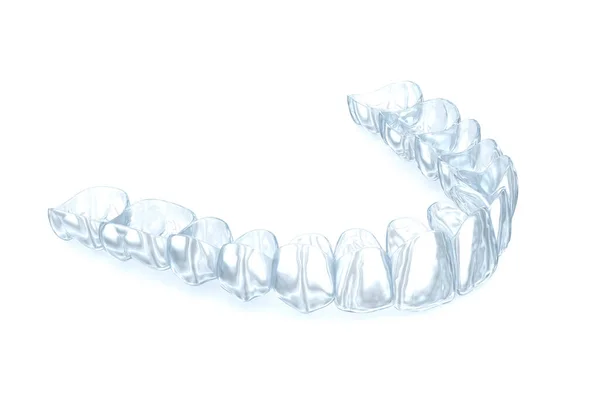 Vizuální Rovnátka Nebo Neviditelné Rovnátka Bílém Lékařsky Přesná Zubní Ilustrace — Stock fotografie