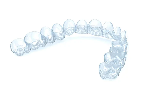 白色上的异形矫正器或隐形器 医学上准确的牙科3D图像 — 图库照片