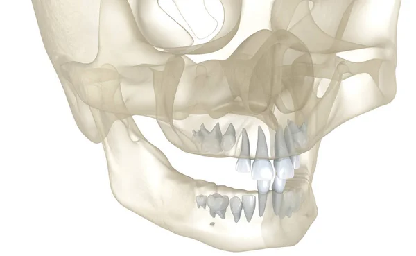 Baby Primaire Tand Uitbarsting Medisch Nauwkeurige Tandheelkundige Illustratie — Stockfoto