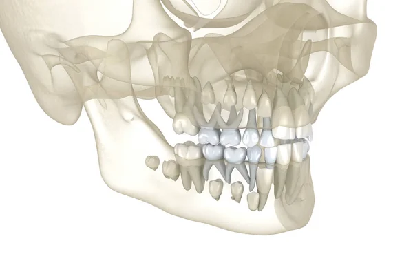Trwała Erupcja Zęba Utrata Głównych Zębów Medycznie Dokładna Ilustracja — Zdjęcie stockowe