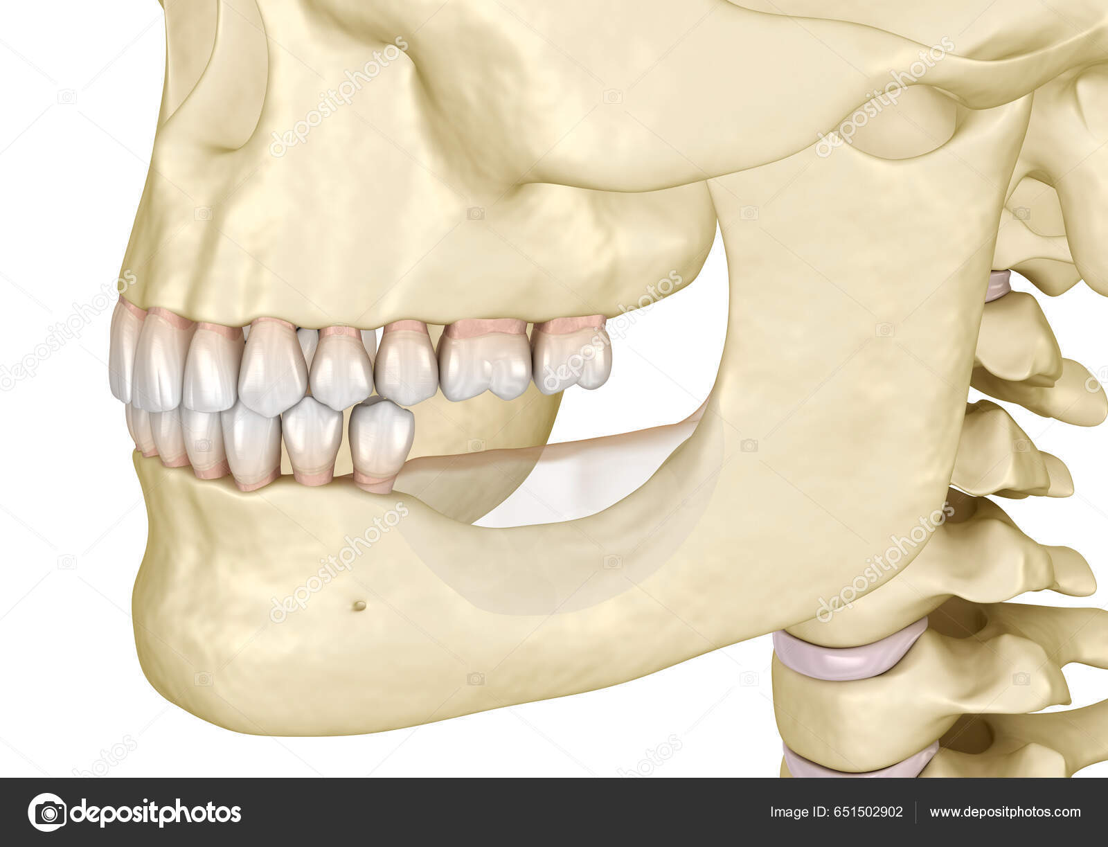 Mandibular Jaw Bone Recession Losing Molars Teeth Dental Illustration
