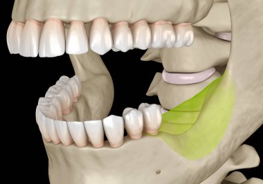 Alt çene, azı dişlerini kaybettikten sonra kemik durgunluğu. Diş 3B illüstrasyon