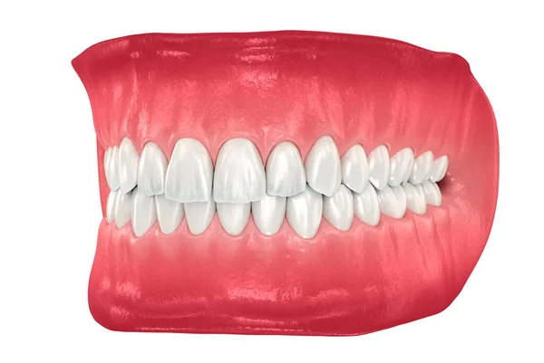 Friska Mänskliga Tänder Med Normal Ocklusion Illustration För Tandläkare — Stockfoto