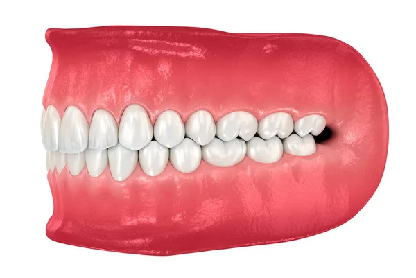 Denti Umani Sani Con Normale Occlusione Illustrazione Dentale — Foto Stock