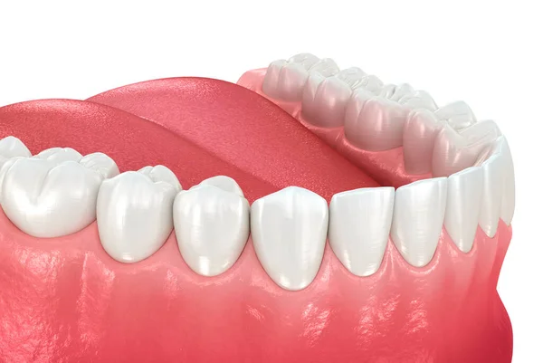 Denti Umani Sani Con Normale Occlusione Illustrazione Dentale — Foto Stock