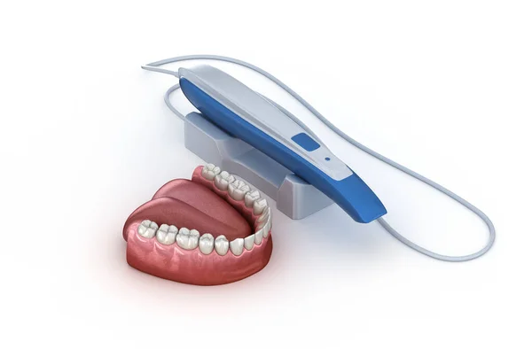 Escáner Dientes Intraorales Propio Diseño Concepto Ilustración Dental —  Fotos de Stock