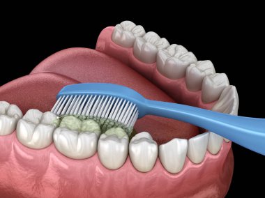 Diş fırçası diş temizliği. Ağız hijyeninin tıbbi açıdan doğru üç boyutlu çizimi.