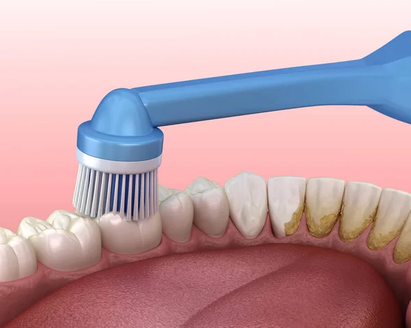 电动牙刷清洁牙齿 用白色隔开 口腔卫生的医学上准确的3D图像 — 图库照片