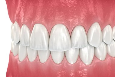 Normal tıkantılı sağlıklı insan dişleri, yan görünüm. Tıbbi olarak doğru diş 3d illüstrasyon