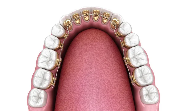 Zdravé Zuby Zlatými Rovnátky Koncept Bílého Stylu Zubní Ilustrace — Stock fotografie