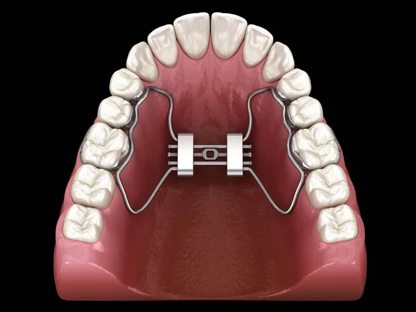 出生前早期拡大 医学的に正確な歯3Dイラスト ストックフォト