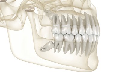 Yirmilik dişlerin kafa karıştırıcı etkisi. Tıbbi olarak doğru diş 3D illüstrasyon