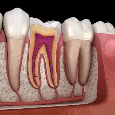 Detaylarda molar anatomi. İnsan dişlerinin 3 boyutlu çizimi