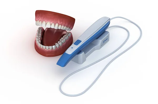 Intraoral Teeth Scanner Own Design Dental Illustration Concept — Stock Photo, Image