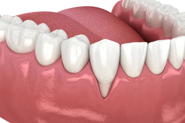 リセプション 歯科問題の3Dイラスト — ストック写真