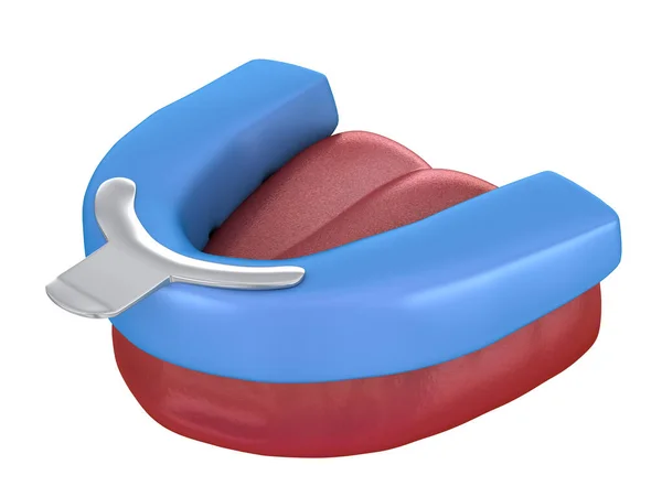 歯の印象 治療計画 医学的に正確な歯3Dイラスト — ストック写真
