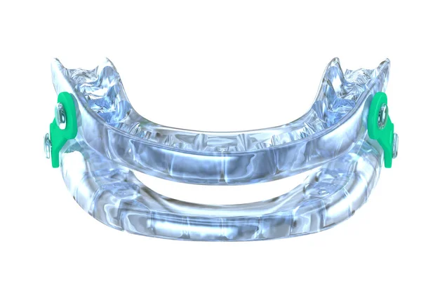 口腔家電治療装置 睡眠時無呼吸治療 3Dイラスト — ストック写真