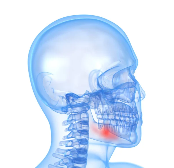 歯科痛の概念 3Dイラスト — ストック写真