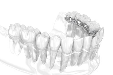 Dil telleri sistemi. Altın diş tellerinin 3D illüstrasyon konsepti