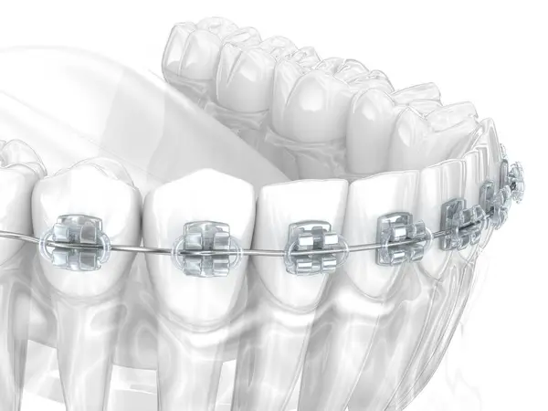 牙龈和牙齿 3D插图 图库图片