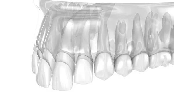 面板安装在中央和侧门上 医学上准确的牙齿3D图像 免版税图库照片