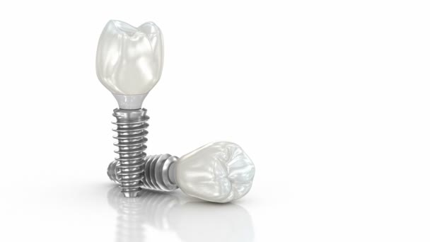 Implant Stomatologiczny Ceramiczna Korona Białym Tle Animacja — Wideo stockowe