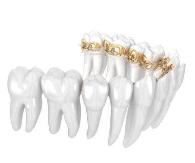 Dil telleri sistemi. Altın diş tellerinin 3D illüstrasyon konsepti
